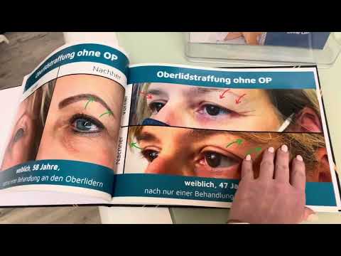 planoplas® Fotobuch Vorher-Nachher-Bilder gedruckt für Wartebereich